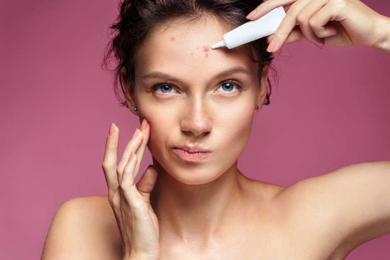 Model applying product on acne