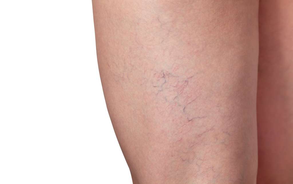 Models Photo of Blood Vessels