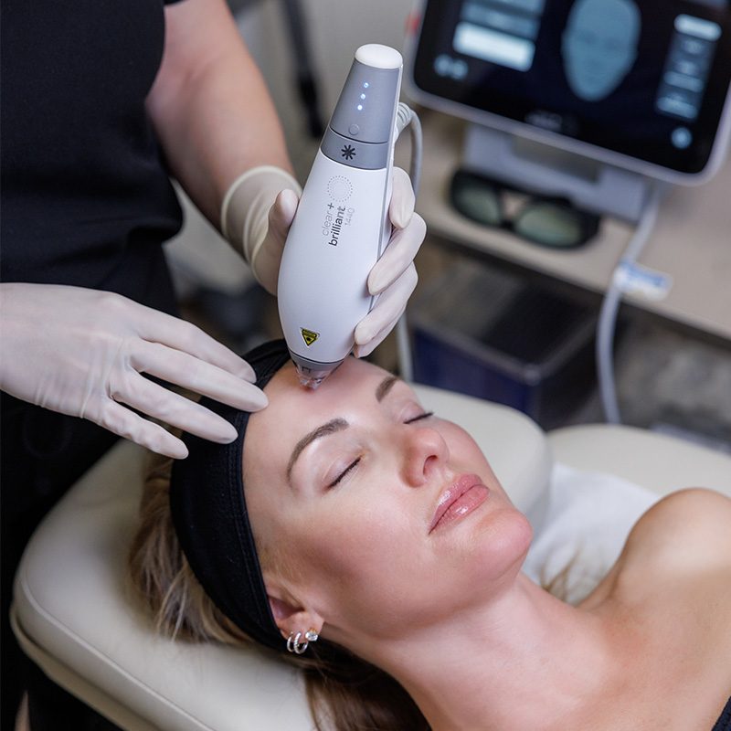 Skin Spectrum patient receiving Clear & Brilliant Treatment